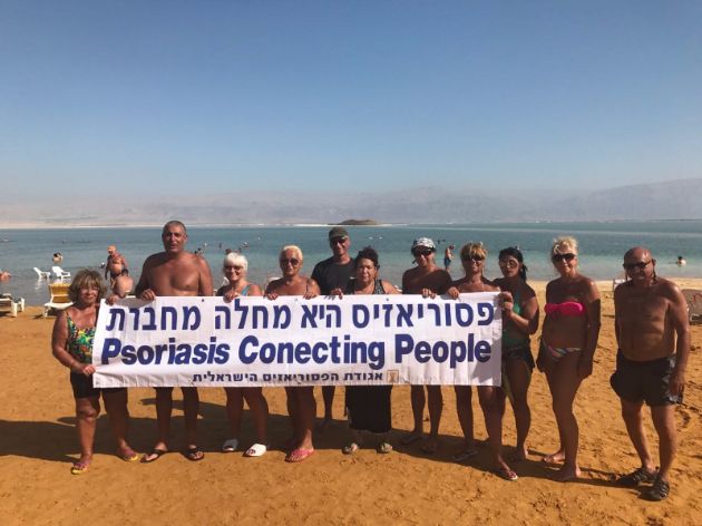 פסוריאזיס היא מחלה מחברת