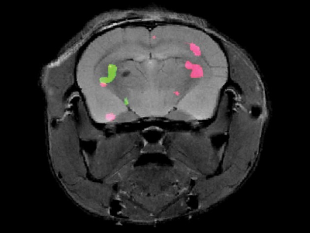 מבעד לרקמות: החיים החדשים של סריקות ה-MRI